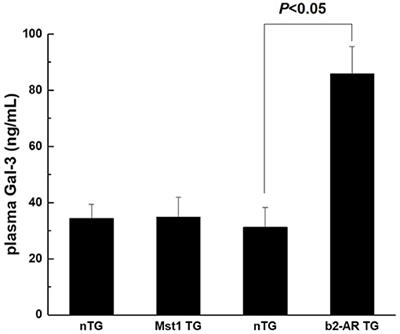 The Diagnostic and Prognostic Value of Plasma Galectin 3 in HFrEF Related to the Etiology of Heart Failure